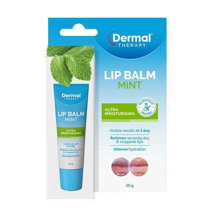 Dermal Therapy Lip Balm Mint For Dry And Chapped Lips 10G