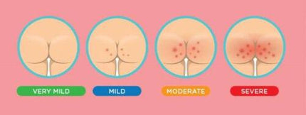 Sudocrem Healing Cream Tub - 400 Grams - OhYouLuckyDuck.com.au