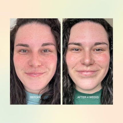 The Jojoba Company Jojoba Boost Skin Barrier Support 30ml