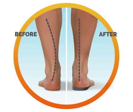 Scholl In Balance Lower Back Orthotic Insole Small - OhYouLuckyDuck.com.au